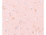 NALP5 Antibody in Immunohistochemistry (Paraffin) (IHC (P))