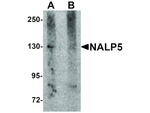 NALP5 Antibody in Western Blot (WB)