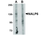 NALP6 Antibody in Western Blot (WB)
