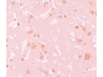 NALP7 Antibody in Immunohistochemistry (Paraffin) (IHC (P))