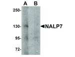 NALP7 Antibody in Western Blot (WB)