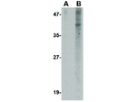 NANOS1 Antibody in Western Blot (WB)