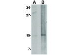 NANOS2 Antibody in Western Blot (WB)