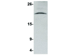 NANOS3 Antibody in Western Blot (WB)