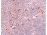 NAT11 Antibody in Immunohistochemistry (Paraffin) (IHC (P))