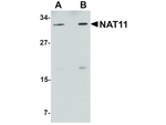 NAT11 Antibody in Western Blot (WB)
