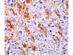 Neurturin Polyclonal Antibody
