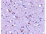 Nhe-1 Antibody in Immunohistochemistry (Paraffin) (IHC (P))