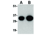 NIPSNAP Antibody in Western Blot (WB)