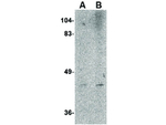 NIPSNAP2 Polyclonal Antibody