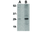 NIPSNAP2 Antibody in Western Blot (WB)