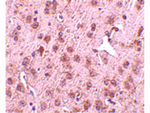 NIPSNAP3A Antibody in Immunohistochemistry (Paraffin) (IHC (P))