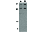 NIPSNAP3A Antibody in Western Blot (WB)