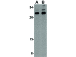 NIPSNAP3B Antibody in Western Blot (WB)