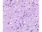 NK3R Antibody in Immunohistochemistry (Paraffin) (IHC (P))