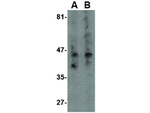 NK3R Antibody in Western Blot (WB)
