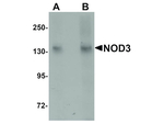 NOD3 Antibody in Western Blot (WB)