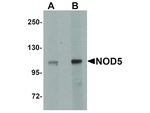 NOD5 Antibody in Western Blot (WB)