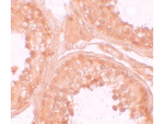 NOD6 Antibody in Immunohistochemistry (Paraffin) (IHC (P))