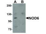 NOD6 Antibody in Western Blot (WB)