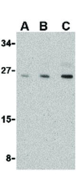Nop30 Polyclonal Antibody