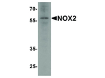 NOX2 Antibody in Western Blot (WB)