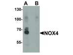 NOX4 Antibody in Western Blot (WB)