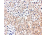 NPC1 Antibody in Immunohistochemistry (Paraffin) (IHC (P))