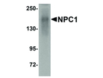 NPC1 Antibody in Western Blot (WB)