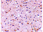 NPTX2 Antibody in Immunohistochemistry (Paraffin) (IHC (P))