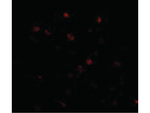 NUP160 Polyclonal Antibody