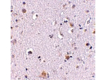 NUP160 Antibody in Immunohistochemistry (Paraffin) (IHC (P))