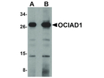 OCIAD1 Polyclonal Antibody