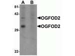 OGFOD2 Polyclonal Antibody