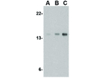 op18 Antibody in Western Blot (WB)