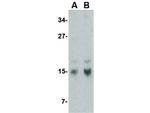 op18 Antibody in Western Blot (WB)