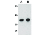 OTUD5 Antibody in Western Blot (WB)