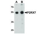 P2RX7 Polyclonal Antibody
