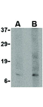 p53AIP1 Antibody in Western Blot (WB)