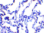 p53R2 Antibody in Immunohistochemistry (Paraffin) (IHC (P))