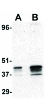 p53R2 Antibody in Western Blot (WB)