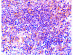 PAK2 Antibody in Immunohistochemistry (Paraffin) (IHC (P))