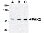 PAK2 Antibody in Western Blot (WB)