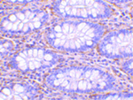 PAK4 Antibody in Immunohistochemistry (Paraffin) (IHC (P))