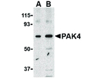 PAK4 Antibody in Western Blot (WB)