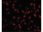 PAK5 Antibody in Immunocytochemistry (ICC/IF)