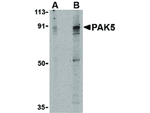 PAK5 Antibody in Western Blot (WB)