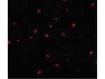 PAK6 Antibody in Immunocytochemistry (ICC/IF)