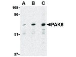 PAK6 Antibody in Western Blot (WB)