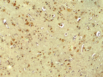 PARK2 Antibody in Immunohistochemistry (Paraffin) (IHC (P))